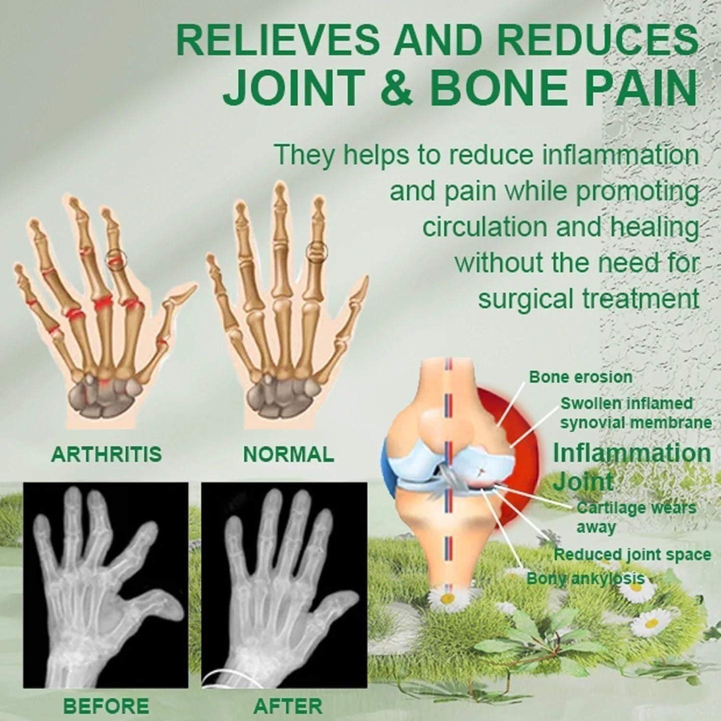 3. Bee Venom Joint and Bone Therapy Cream (Pack of 3)
