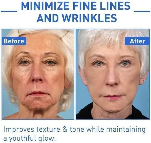 2. Botox Anti-Aging Serum (Pack of 2)